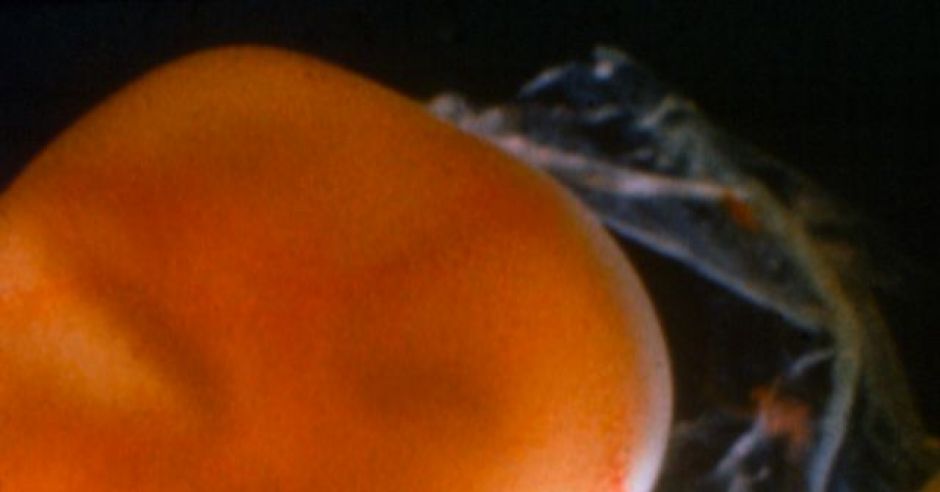 12 tydzień ciąży, zdjęcia ciąży, zdjęcia płodu