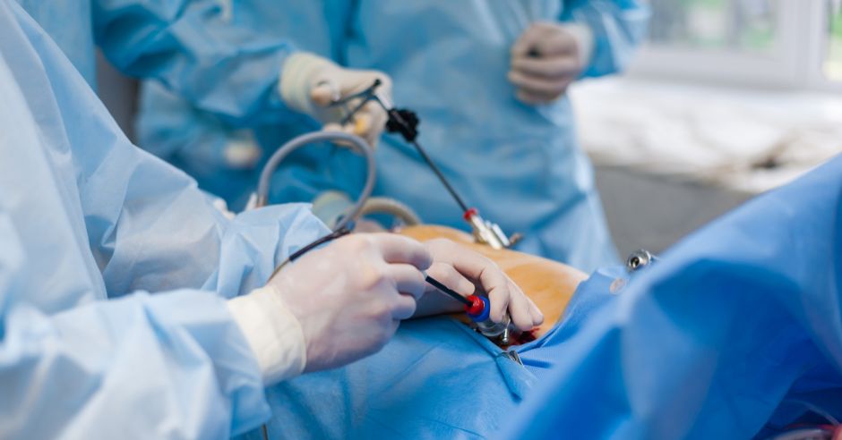 Appendektomia, czyli chirurgiczne usunięcie wyrostka robaczkowego