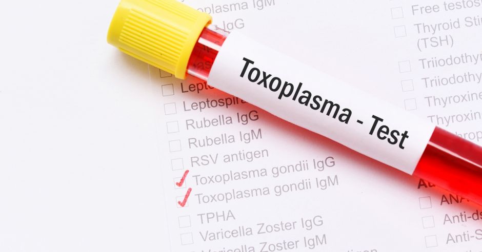 badania na toksoplazmozę