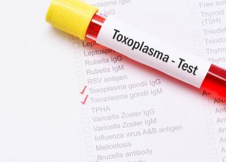 badania na toksoplazmozę