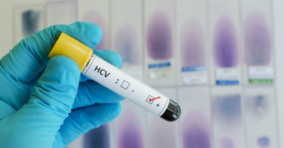 HCV w ciąży