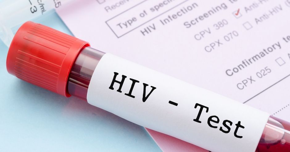 Badanie w kierunku HIV w czasie ciąży
