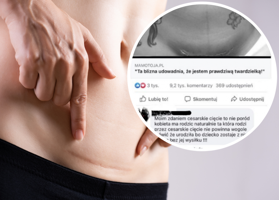 „Cesarka, to nie poród” – grzmi internauta. Duet Make Life Harder odpowiada w mocnych słowach