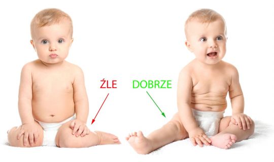 dziecko siada w literę W – pozycja W i prawidłowa