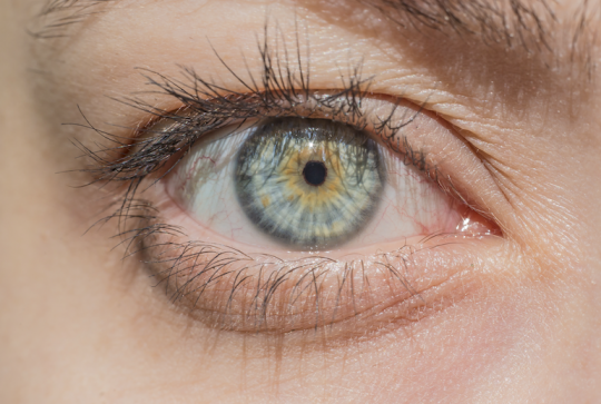 heterochromia centralna