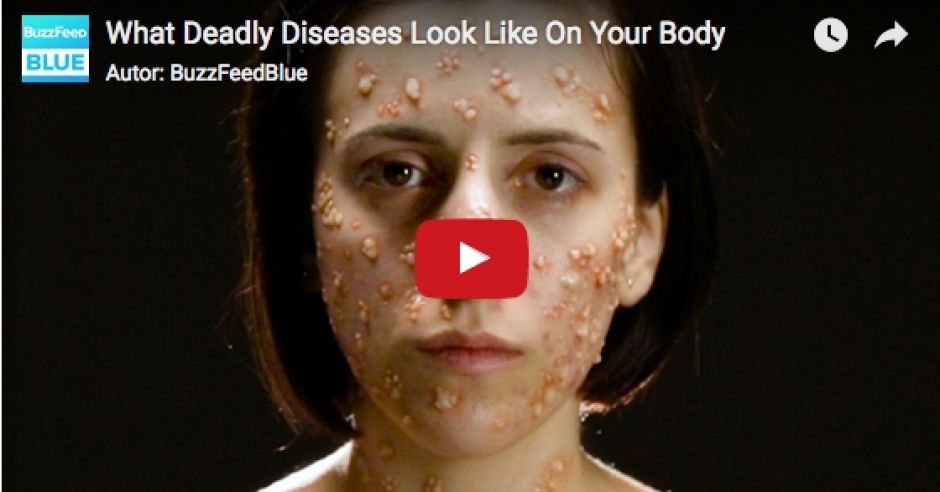 kadr z filmu What Deadly Diseases Look Like On Your Body