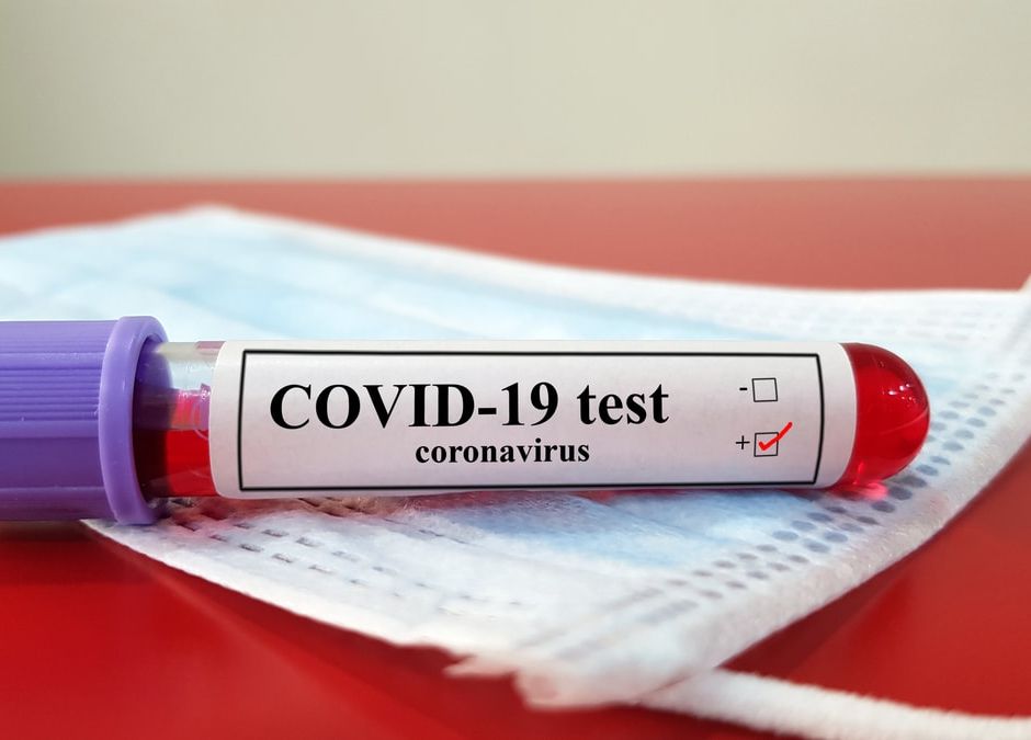 Koronawirus: brak testów na COVID-19. Zakażonych jest nawet 10 razy więcej?