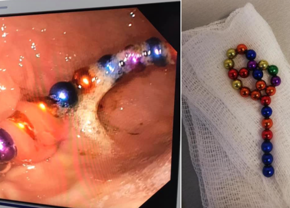 kulki magnesowe neodymowe niebezpieczne