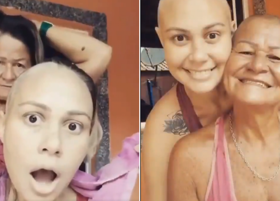 Mama ogoliła głowę z miłości do córki