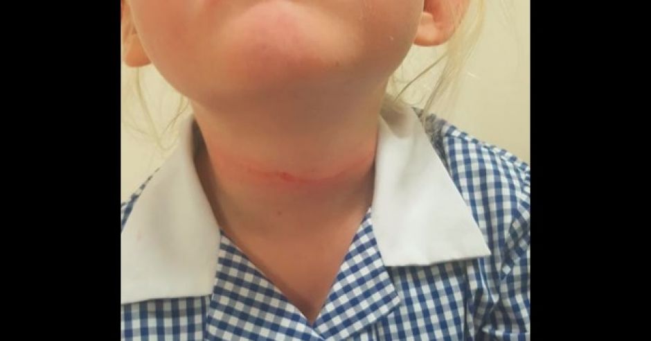 Mama pokazuje zdjęcia córki i ostrzega: te kapelusze grożą uduszeniem
