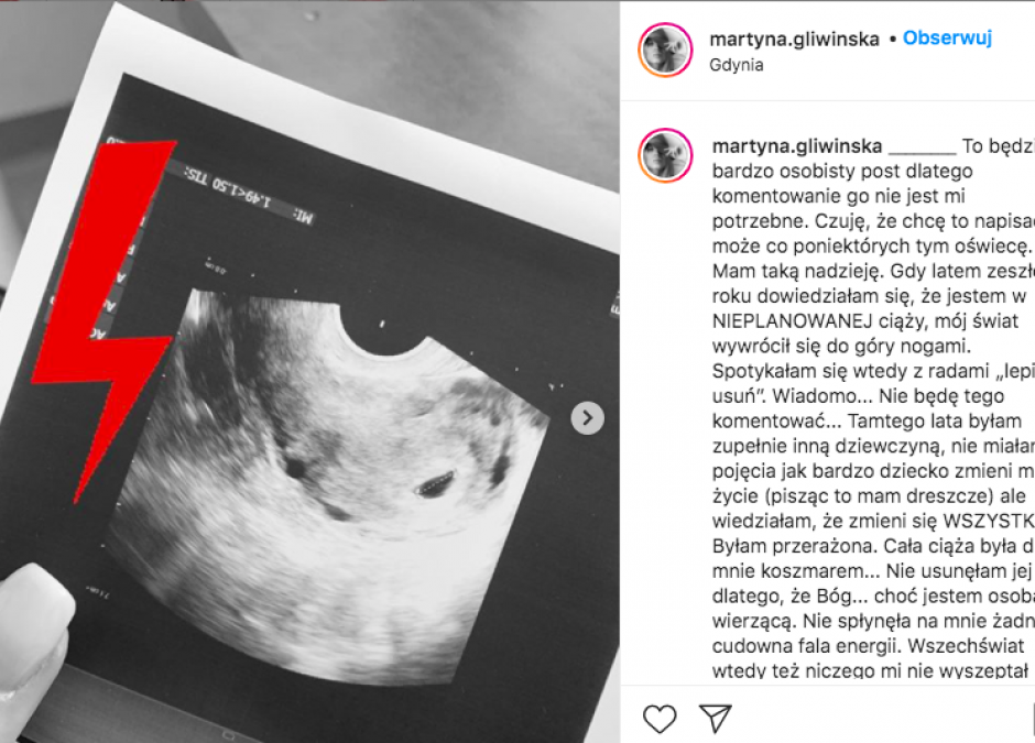 Martyna Gliwińska o nieplanowanej ciąży