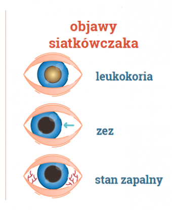 objawy siatkówczaka