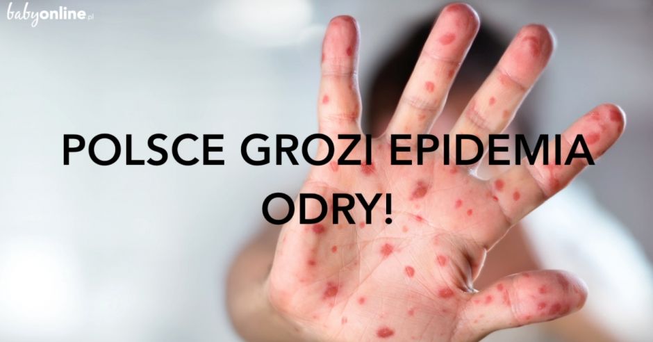 Odra w Polsce - WHO ostrzega przed epidemią! | Mamotoja.pl