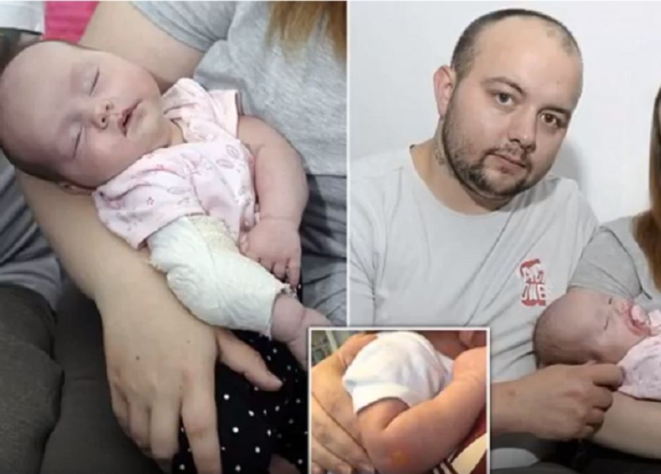 poparzenie dziecka papierosem