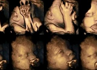 Porównanie zdjęć dziecka kobiety palącej i kobiety bez nałogu