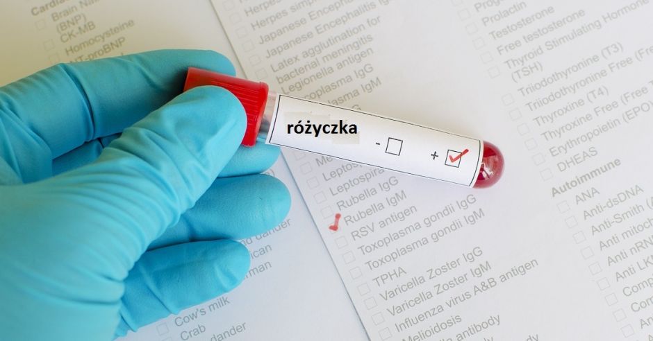 Różyczka, badanie w ciąży