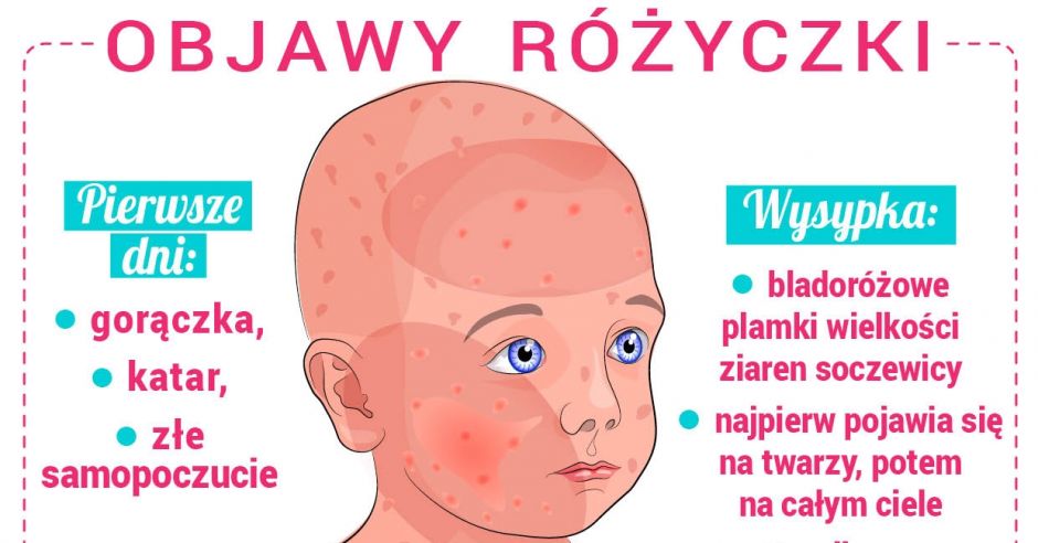 różyczka wysypka infografika