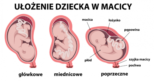ułożenie dziecka w brzuchu schemat