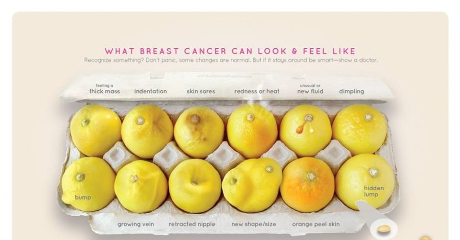 Zdjęcie kampanii Know Your Lemons informującej o raku piersi